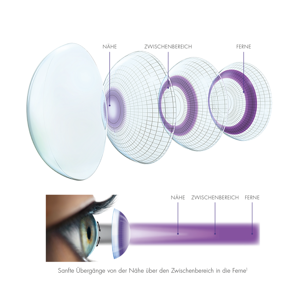 Multifocale Kontaktlinsen